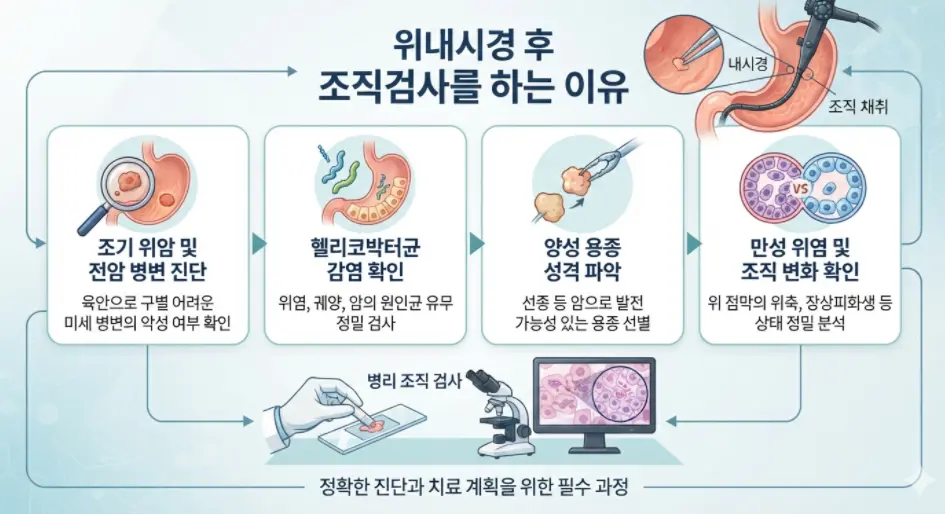 위내시경-후-조직검사-하는-이유